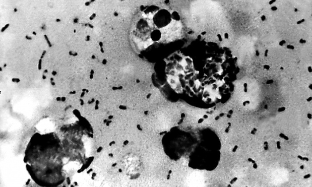 Bubonic-plague-bacteria-014